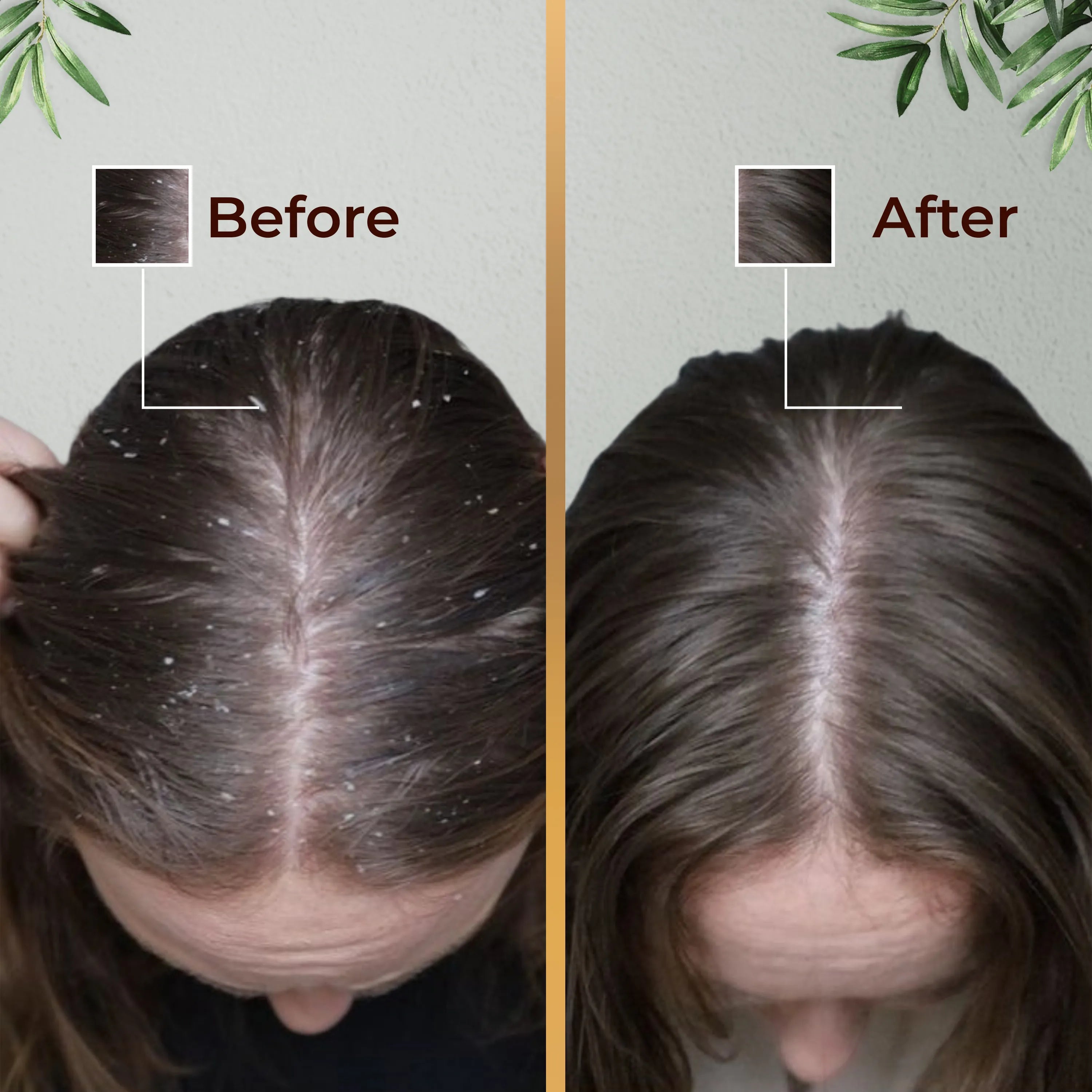 Leucita Anti Dandruff Shampoo for Clean and Flake-Free Scalp